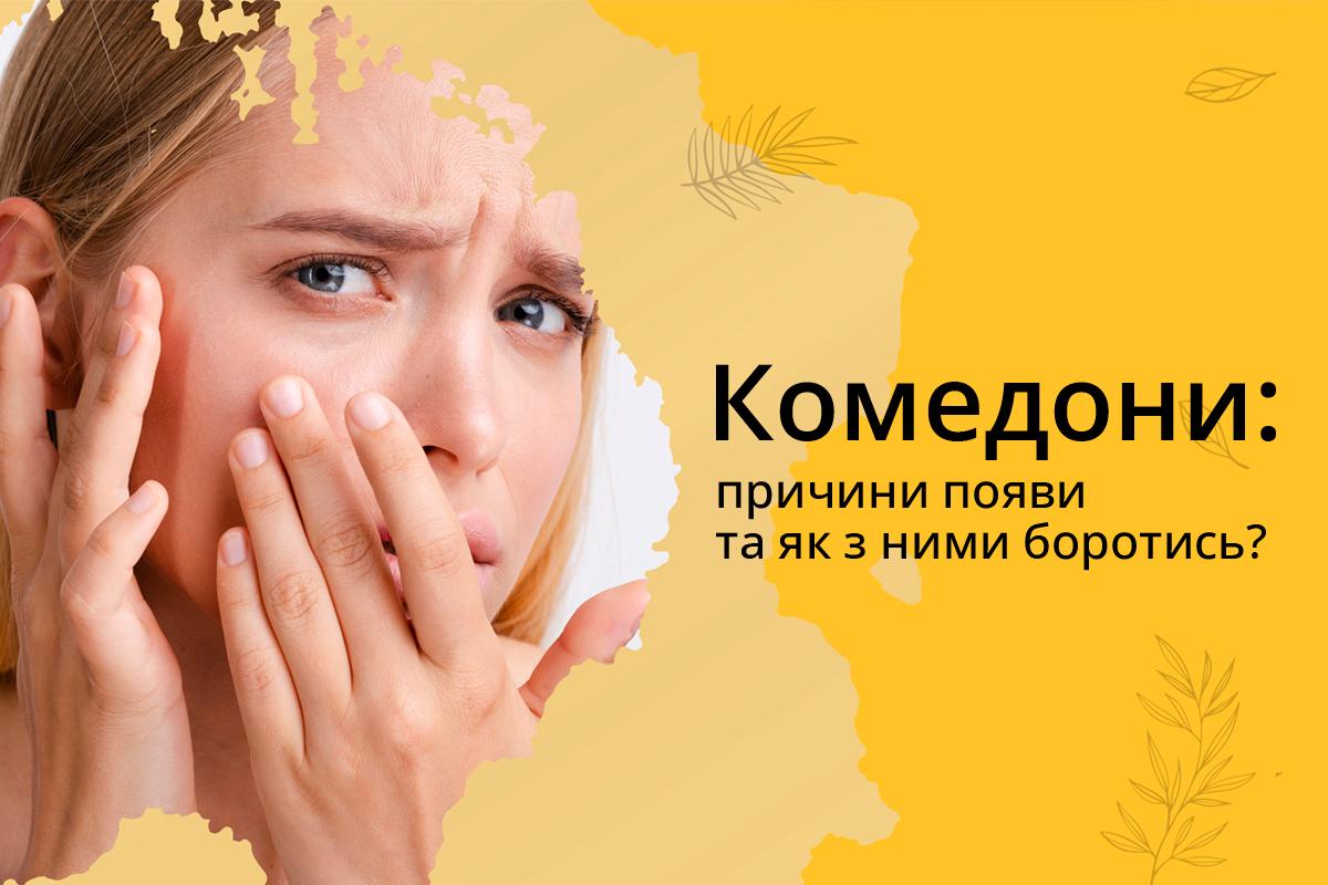 Комедони: причини появи та як з ними боротись?
