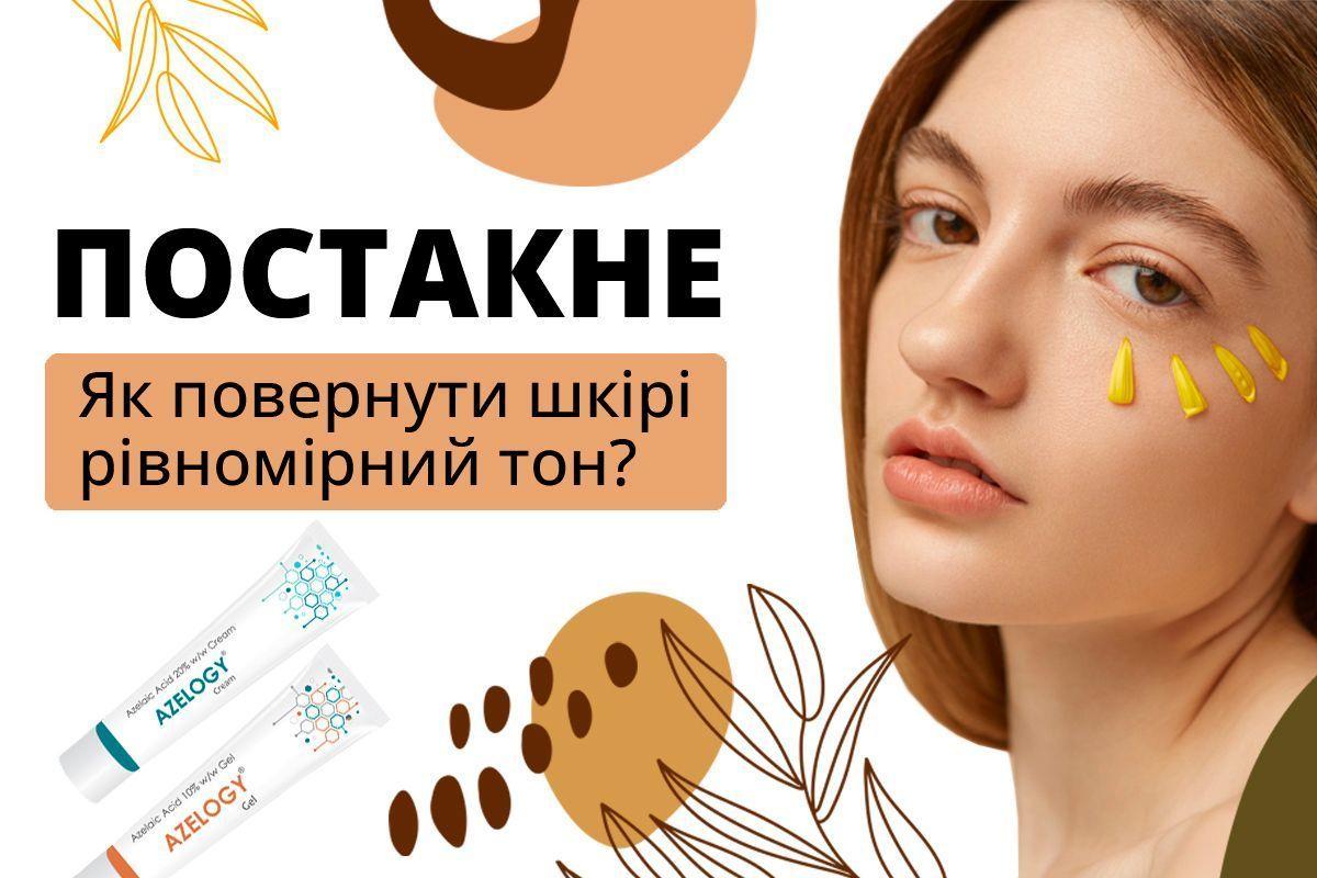 Постакне. Як повернути шкірі рівномірний тон?
