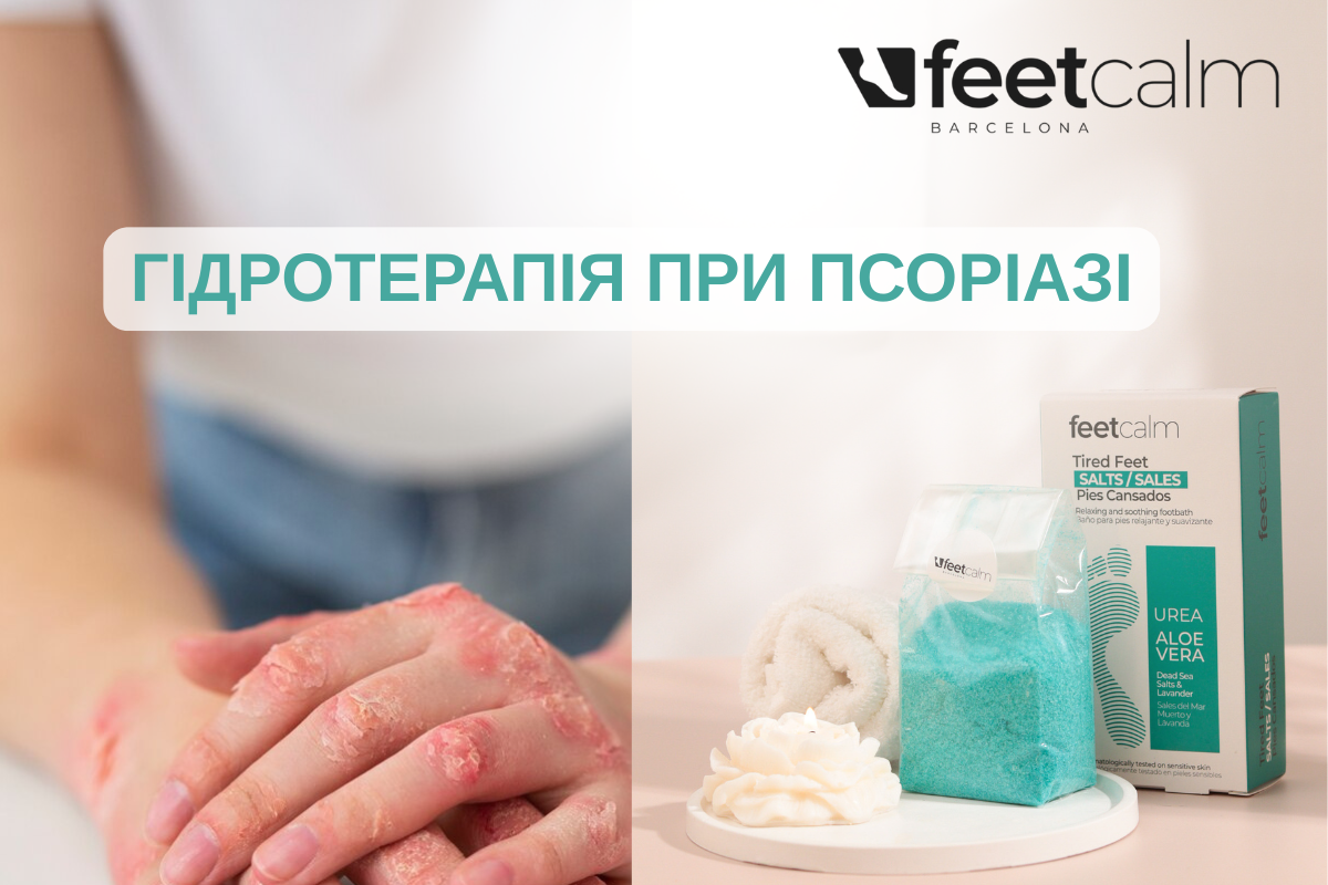 HYDROTHERAPY FOR PSORIASIS